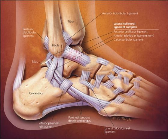 Ankle Sprain & Instability, Dr Mike Smith